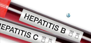 Read more about the article The CDC recommends adults get tested for Hepatitis B at least once
