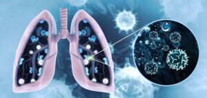 Read more about the article Funding Boosts R&D of Lung Cancer Vaccine from CRIS Cancer Foundation and Cancer Research UK
